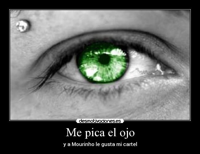 Me pica el ojo - y a Mourinho le gusta mi cartel