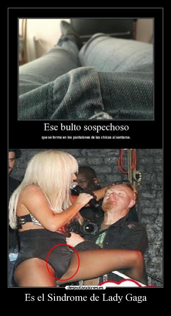 Es el Sindrome de Lady Gaga - 