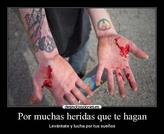 Por muchas heridas que te hagan - Levántate y lucha por tus sueños