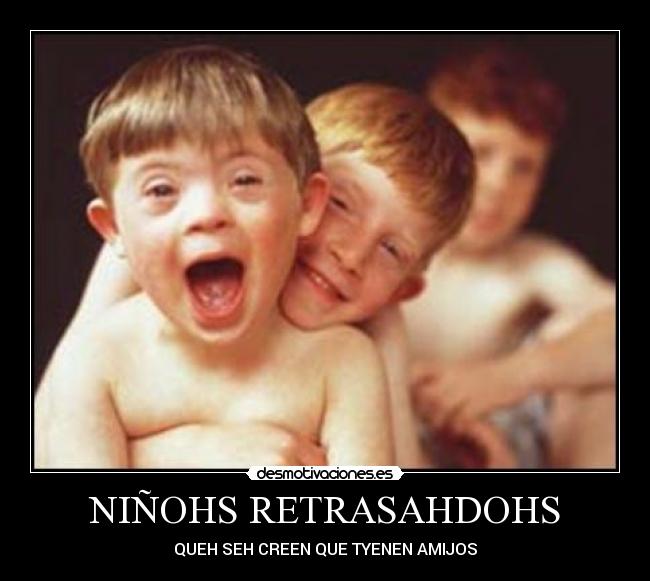 NIÑOHS RETRASAHDOHS - 