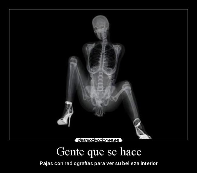 Gente que se hace - Pajas con radiografías para ver su belleza interior