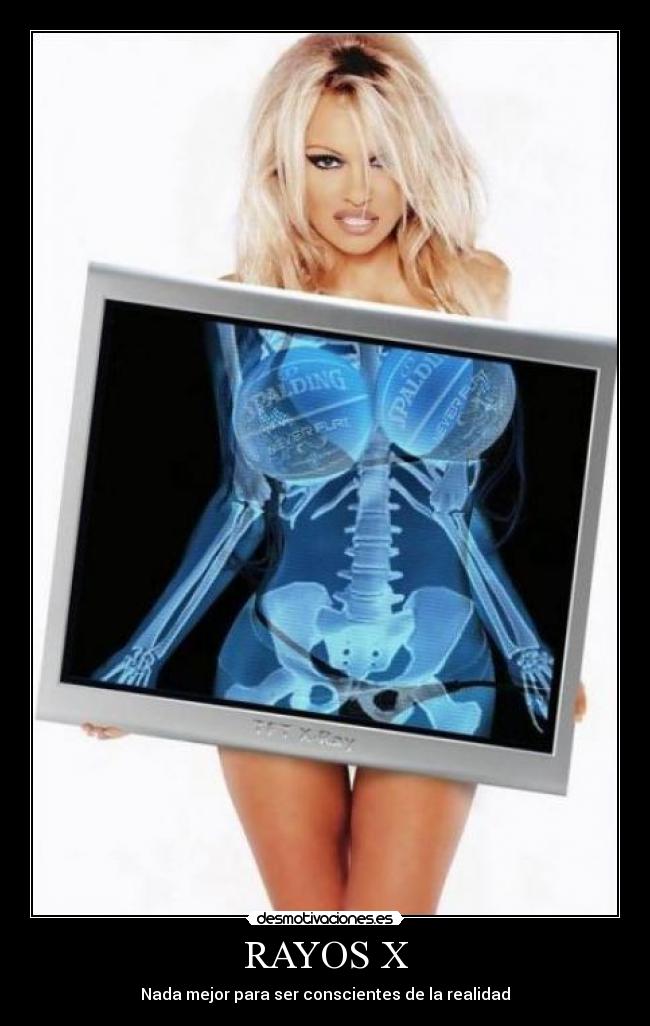 RAYOS X - Nada mejor para ser conscientes de la realidad