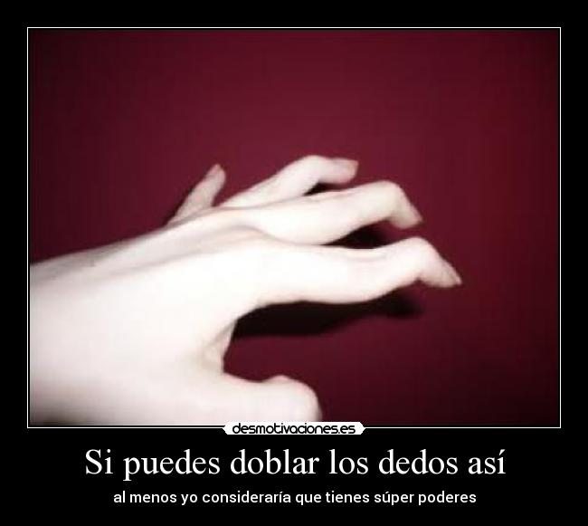 Si puedes doblar los dedos así - 