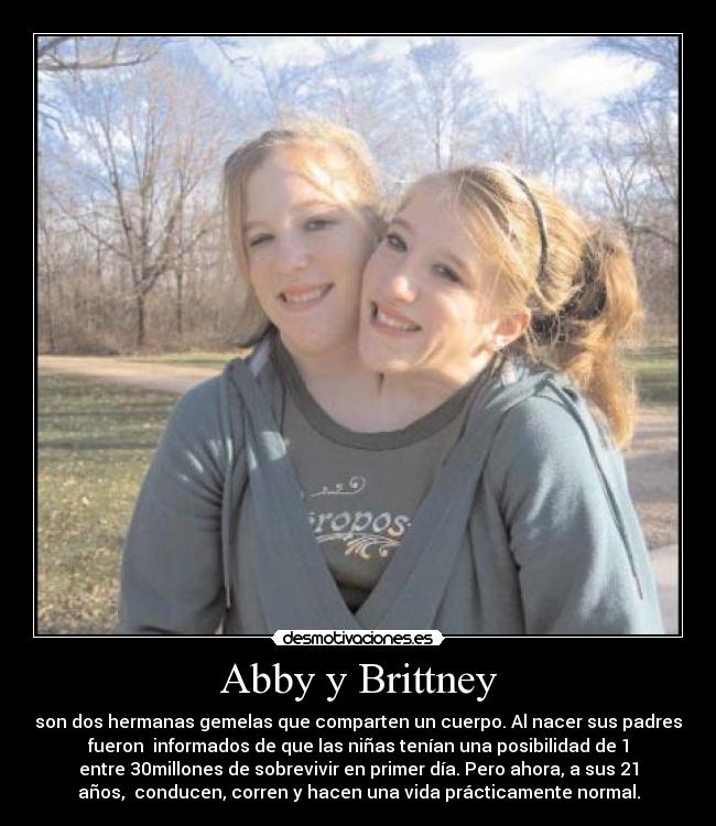 Abby y Brittney -