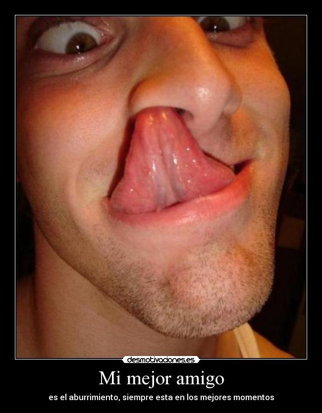 Mi mejor amigo -