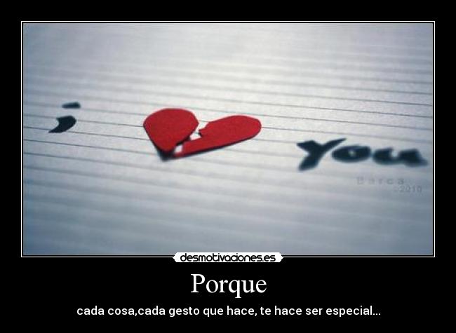 Porque - cada cosa,cada gesto que hace, te hace ser especial...