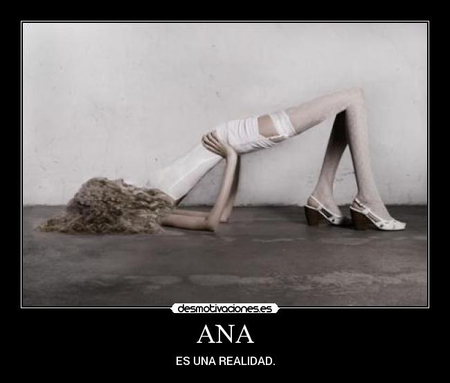ANA - 