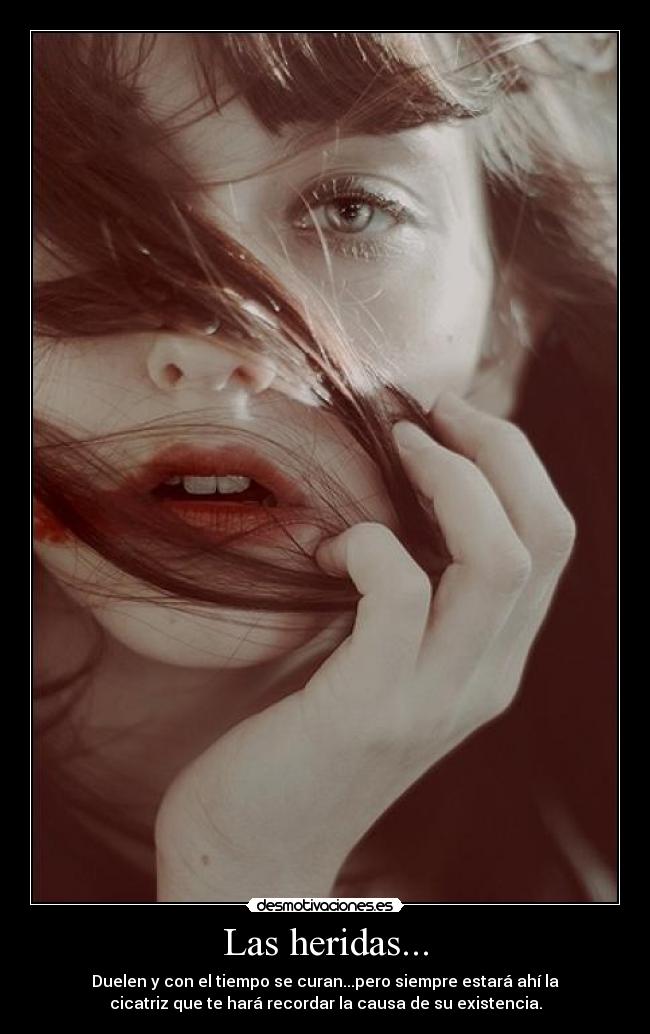 Las heridas... - Duelen y con el tiempo se curan...pero siempre estará ahí la
cicatriz que te hará recordar la causa de su existencia.