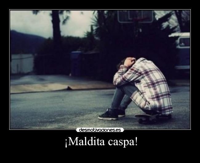 ¡Maldita caspa! -