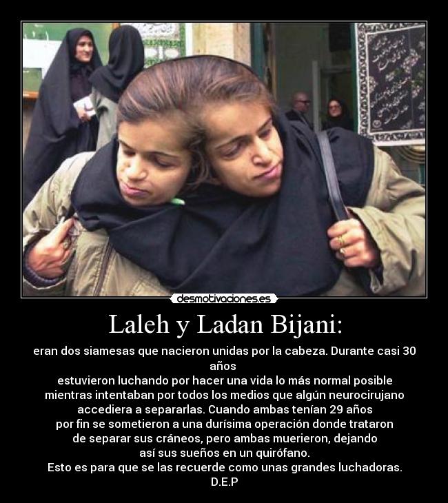 Laleh y Ladan Bijani: - eran dos siamesas que nacieron unidas por la cabeza. Durante casi 30 años 
estuvieron luchando por hacer una vida lo más normal posible
mientras intentaban por todos los medios que algún neurocirujano
accediera a separarlas. Cuando ambas tenían 29 años
por fin se sometieron a una durísima operación donde trataron
de separar sus cráneos, pero ambas muerieron, dejando
así sus sueños en un quirófano.
Esto es para que se las recuerde como unas grandes luchadoras.
D.E.P