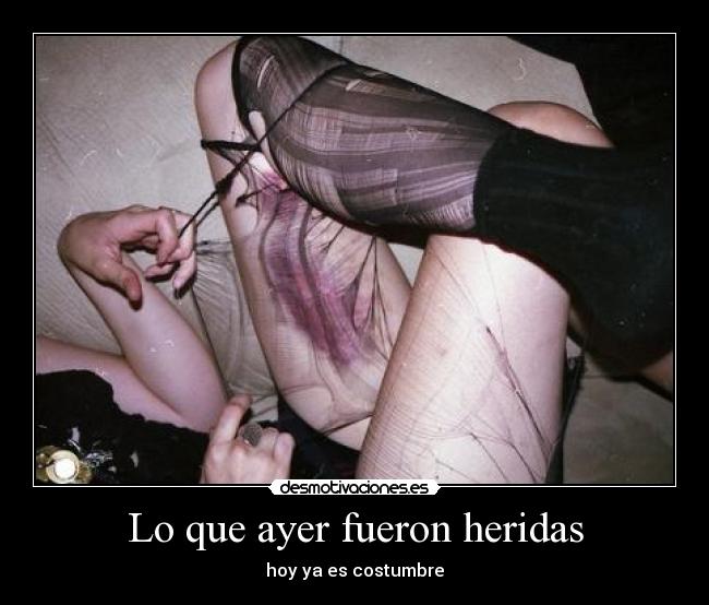 Lo que ayer fueron heridas - hoy ya es costumbre