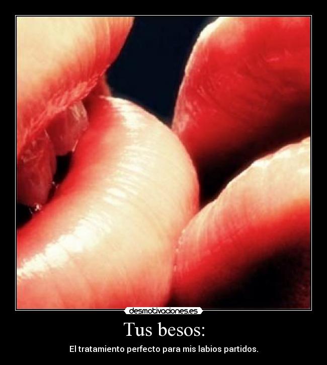 Tus besos: - El tratamiento perfecto para mis labios partidos.