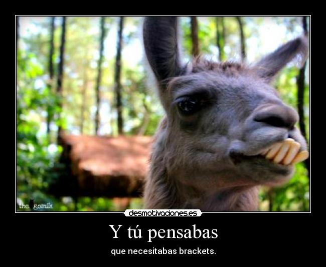 Y tú pensabas - que necesitabas brackets.