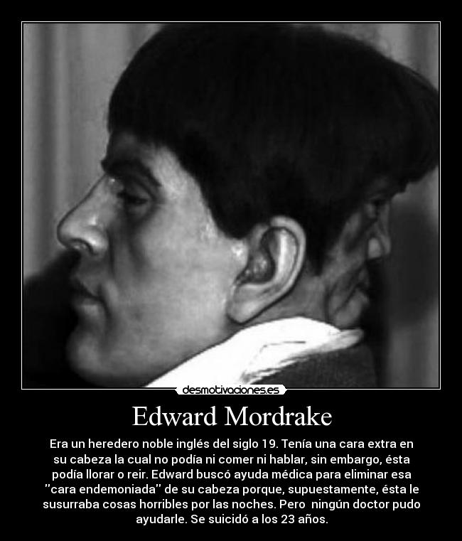 Edward Mordrake -