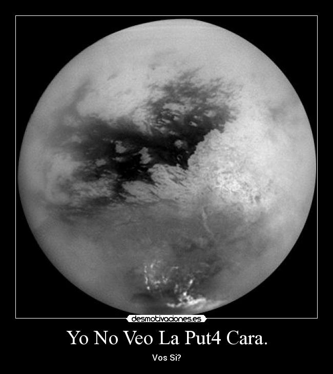 Yo No Veo La Put4 Cara. - Vos Si?