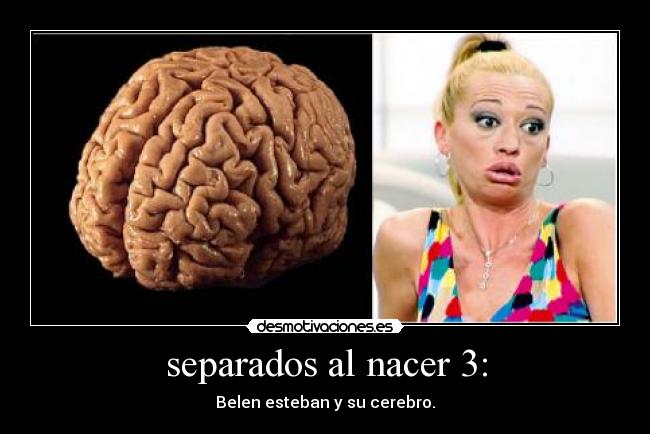separados al nacer 3: - 