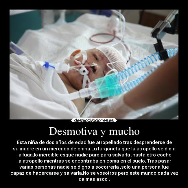 Desmotiva y mucho - Esta niña de dos años de edad fue atropellado tras desprenderse de
su madre en un mercado de china.La furgoneta que la atropello se dio a
la fuga,lo increible esque nadie paro para salvarla ,hasta otro coche
la atropello mientras se encontraba en coma en el suelo. Tras pasar
varias personas nadie se digno a socorrerla ,solo una persona fue
capaz de hacercarse y salvarla.No se vosotros pero este mundo cada vez
da mas asco .