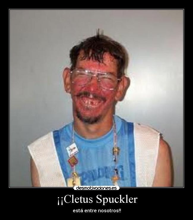 ¡¡Cletus Spuckler - está entre nosotros!!