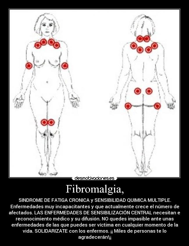 Fibromalgia, - SINDROME DE FATIGA CRONICA y SENSIBILIDAD QUIMICA MULTIPLE.
Enfermedades muy incapacitantes y que actualmente crece el número de
afectados. LAS ENFERMEDADES DE SENSIBILIZACIÓN CENTRAL necesitan el
reconocimiento médico y su difusión. NO quedes impasible ante unas
enfermedades de las que puedes ser víctima en cualquier momento de la
vida. SOLIDARIZATE con los enfermos. ¡¡ Miles de personas te lo
agradecerán!¡¡
