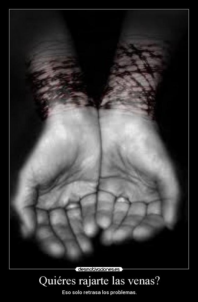 Quiéres rajarte las venas? -