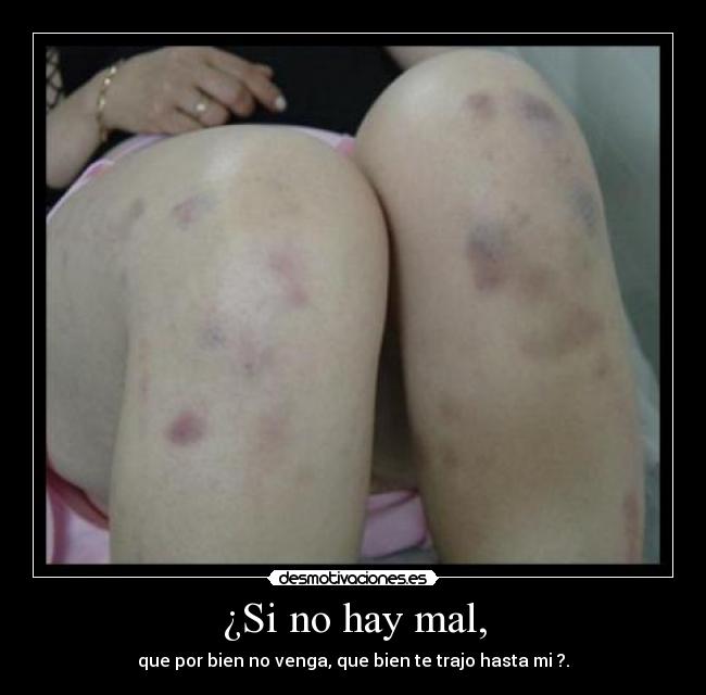 ¿Si no hay mal, - 