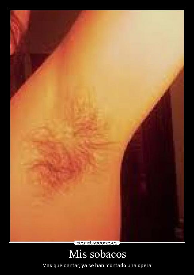 Mis sobacos - Mas que cantar, ya se han montado una opera.