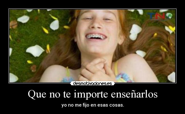 carteles sonrisa brackets desmotivaciones