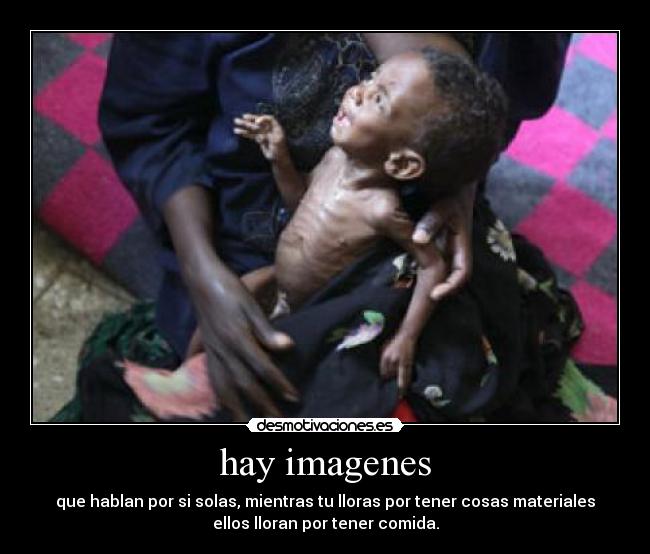 hay imagenes - que hablan por si solas, mientras tu lloras por tener cosas materiales
ellos lloran por tener comida.