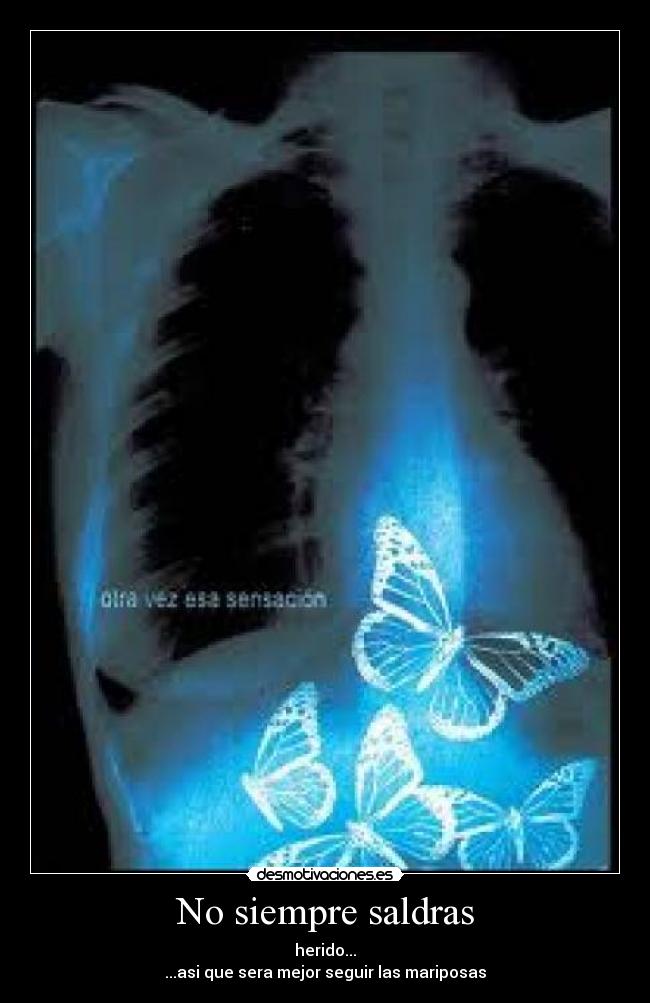 No siempre saldras - herido...
...asi que sera mejor seguir las mariposas