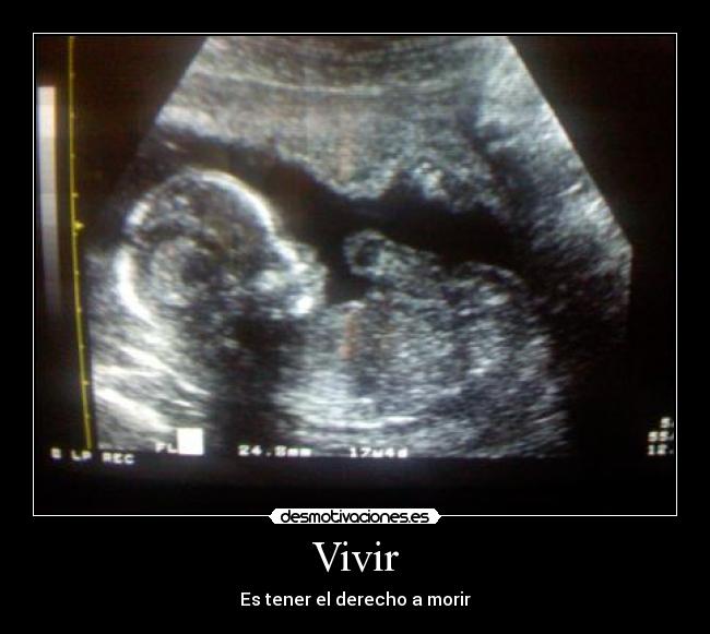 Vivir - Es tener el derecho a morir