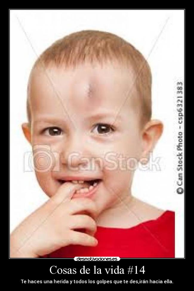 Cosas de la vida #14 - Te haces una herida y todos los golpes que te des,irán hacia ella.