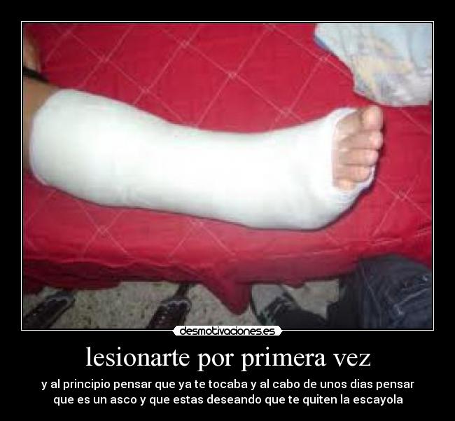 lesionarte por primera vez - y al principio pensar que ya te tocaba y al cabo de unos dias pensar
que es un asco y que estas deseando que te quiten la escayola