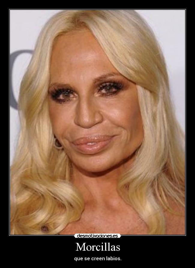 Morcillas - que se creen labios.