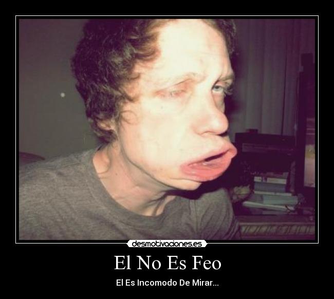 El No Es Feo -