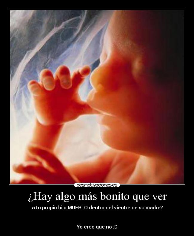 ¿Hay algo más bonito que ver - a tu propio hijo MUERTO dentro del vientre de su madre?
Yo creo que no :D