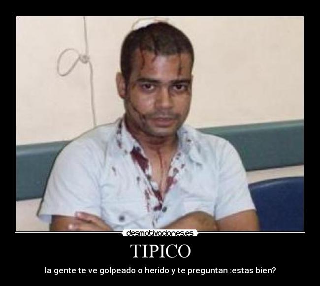 TIPICO - la gente te ve golpeado o herido y te preguntan :estas bien?