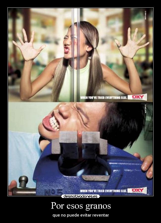 Por esos granos - que no puede evitar reventar