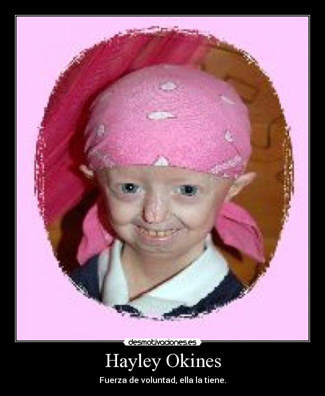Hayley Okines - 