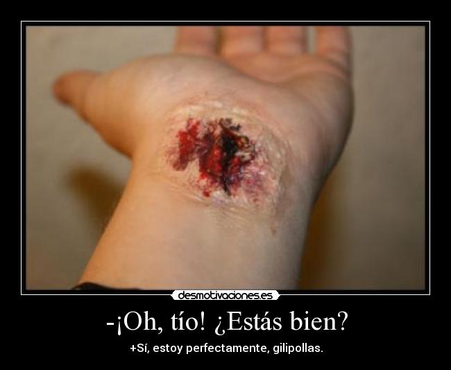 -¡Oh, tío! ¿Estás bien? -