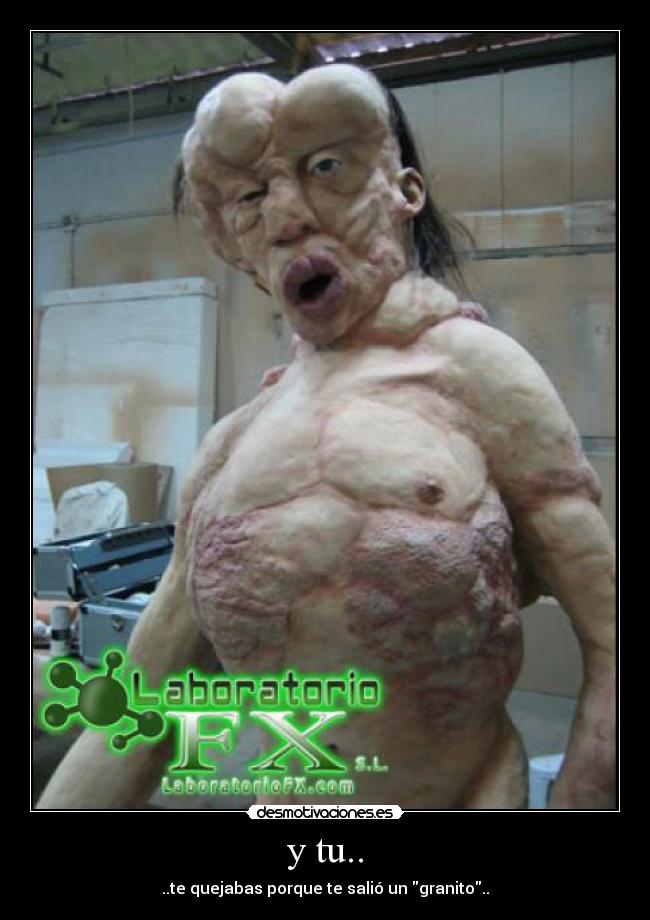 y tu.. - ..te quejabas porque te salió un granito..