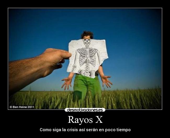 Rayos X - Como siga la crisis así serán en poco tiempo