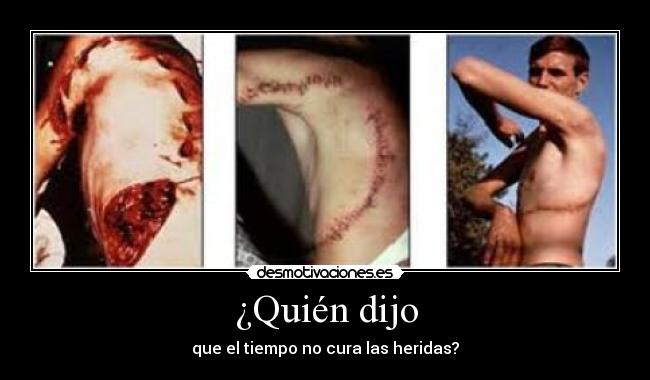 ¿Quién dijo - que el tiempo no cura las heridas?