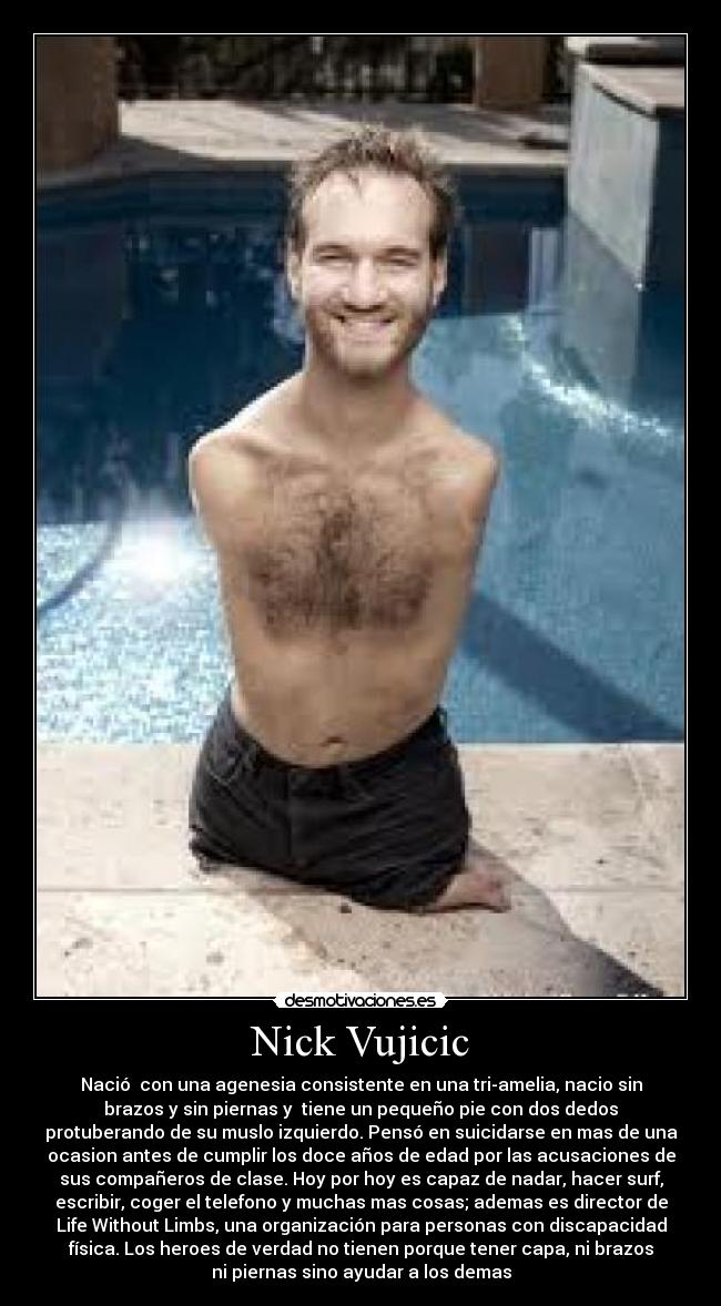 Nick Vujicic - 