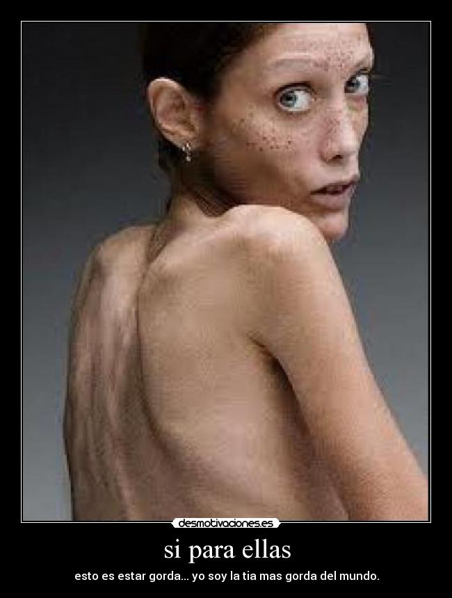 si para ellas - esto es estar gorda... yo soy la tia mas gorda del mundo.