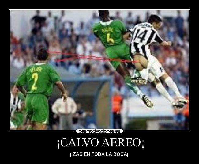 ¡CALVO AEREO¡ -