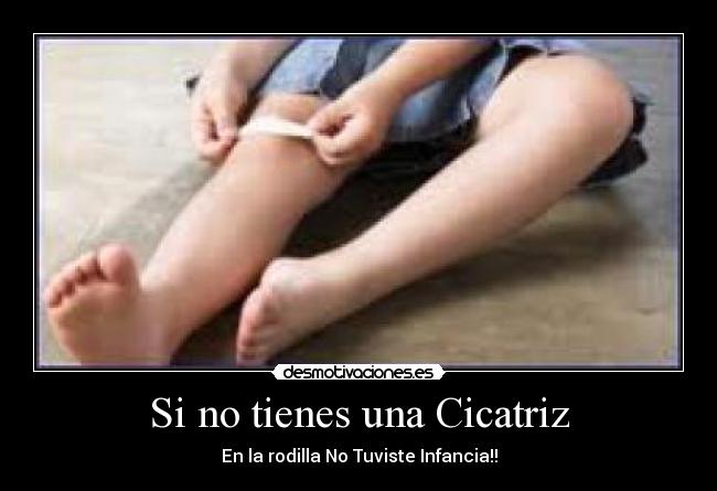 Si no tienes una Cicatriz - En la rodilla No Tuviste Infancia!!