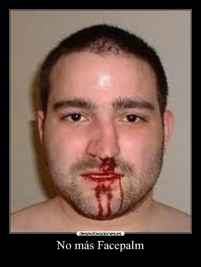 No más Facepalm -