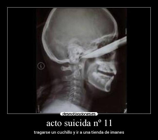 acto suicida nº 11 - tragarse un cuchillo y ir a una tienda de imanes