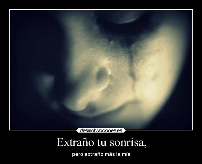 Extraño tu sonrisa, -