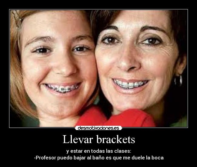 Llevar brackets -